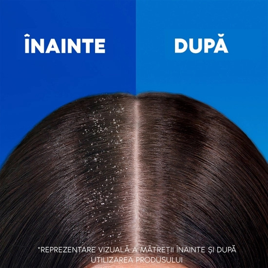 HEAD&SHOULDERS Absolut Volume, sampon, 330 ml infant-ro